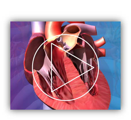 Visual Consult demo